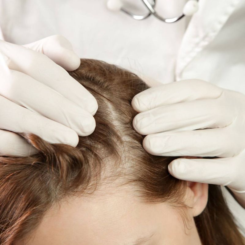 Ignoring Scalp Health