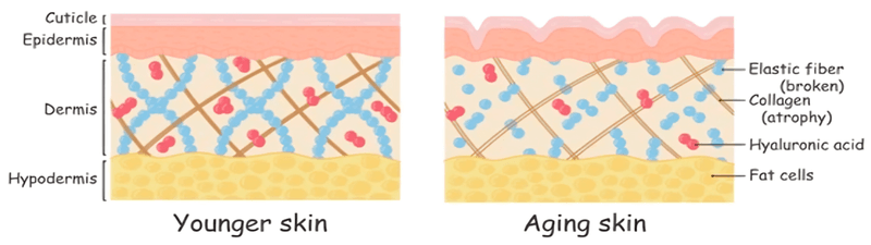 Collagen Creams Replace Lost Collagen