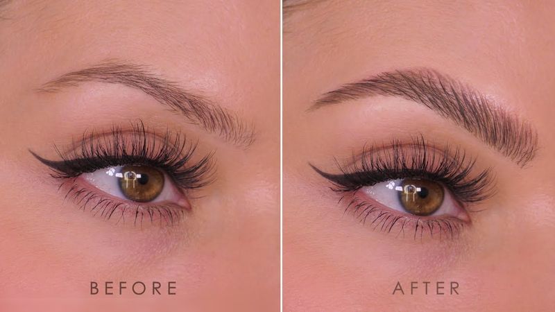 Eyebrow Reshaping