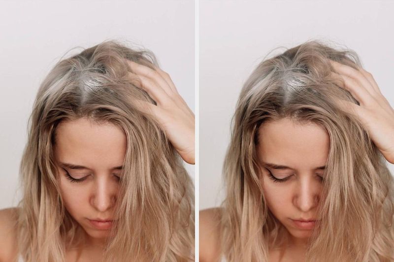 Excessive Dry Shampoo Dependency
