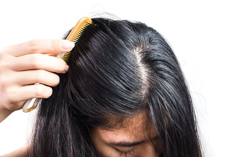 Neglecting Scalp Health