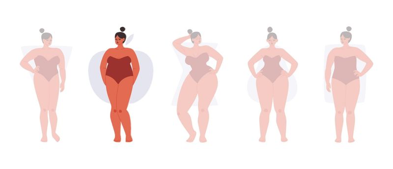 Ignoring Waist Definition in Apple Shapes