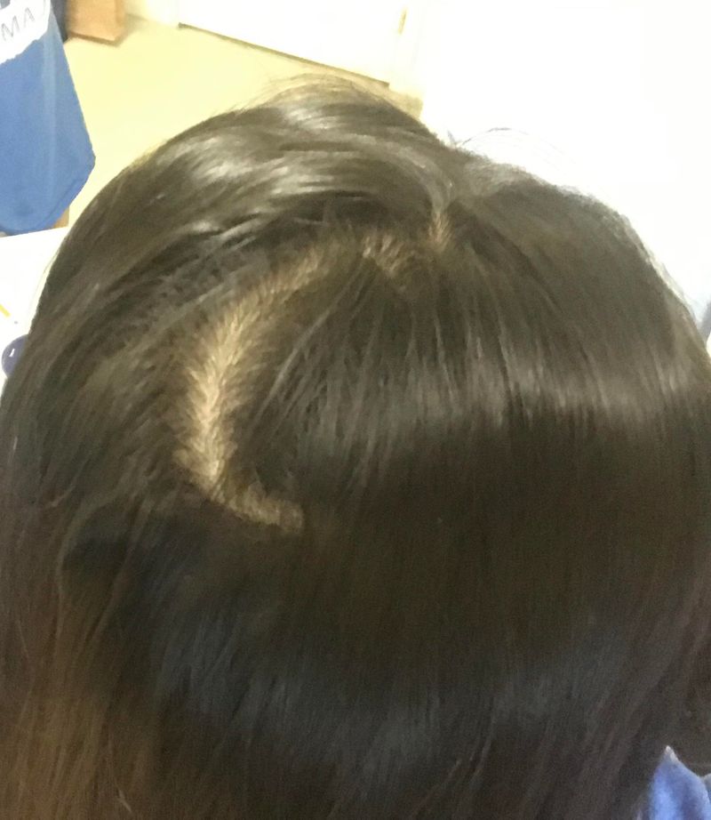 The Crooked Parting