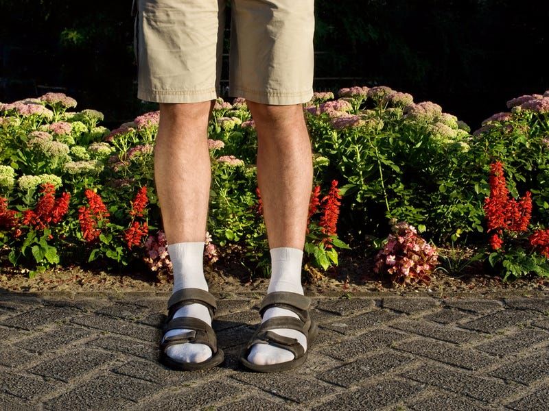 Sock-Sandal Syndrome