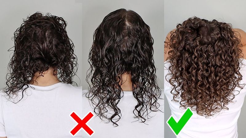 The Forgotten Crown Syndrome