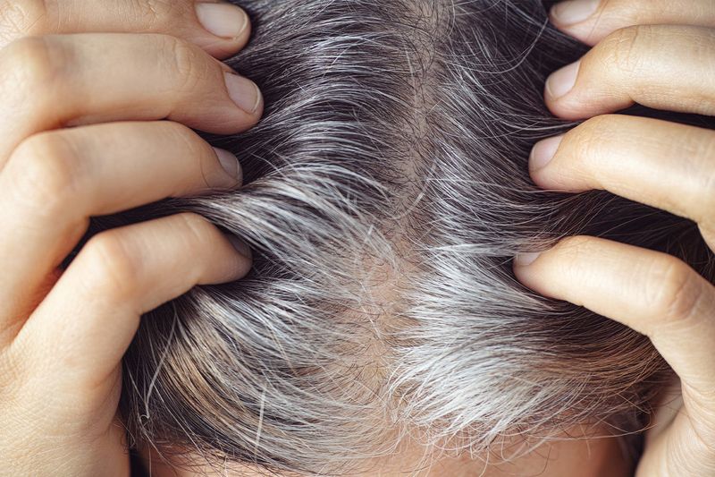 Overusing Dry Shampoo