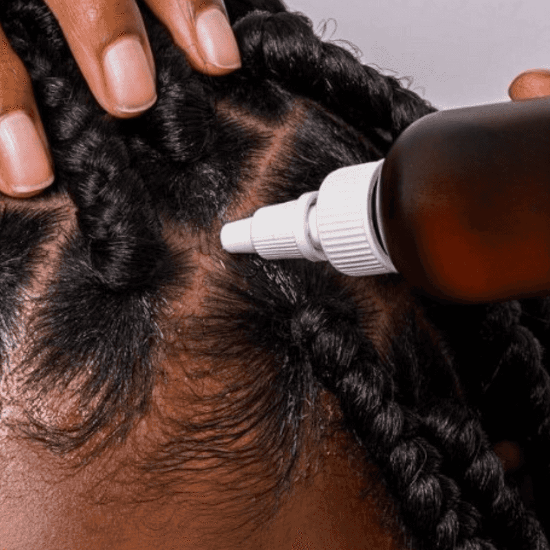 Neglecting Scalp Health
