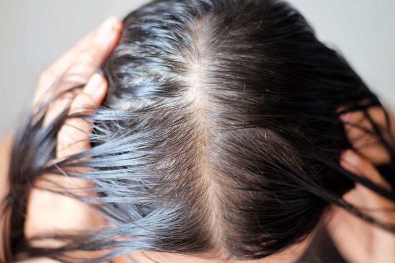 Skipping Scalp Care